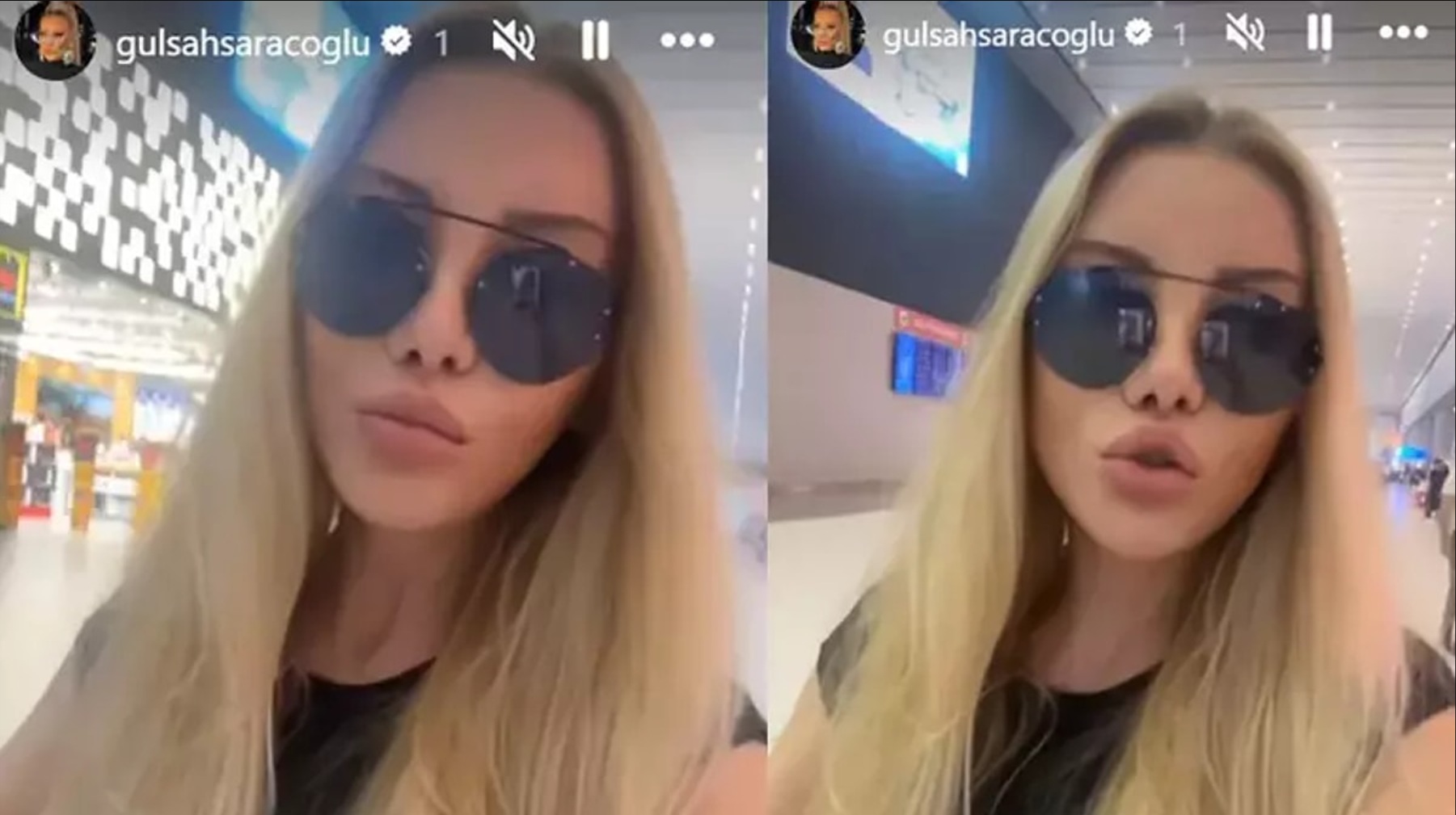 Gülşah Saraçoğlu 9 Saat Süren Estetikten Tanınmaz Hale Geldi